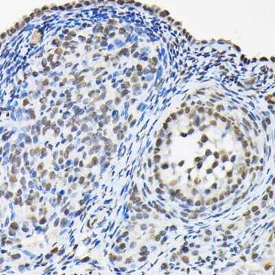 Immunohistochemistry-Paraffin: HNRPA3 Antibody - Azide and BSA Free [NBP3-15982]
