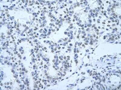 Immunohistochemistry: HNRPH3 Antibody [NBP1-57163]