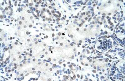 Immunohistochemistry-Paraffin: HNRPH3 Antibody [NBP1-57163]
