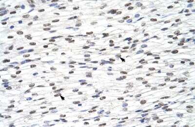 Immunohistochemistry-Paraffin: HNRPLL Antibody [NBP2-85054]