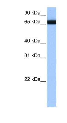 Western Blot: HNRPLL Antibody [NBP1-57407]