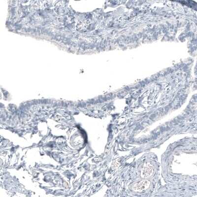 Immunohistochemistry-Paraffin: HO-1/HMOX1/HSP32 Antibody (CL11669) [NBP3-15122]