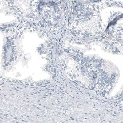 Immunohistochemistry-Paraffin: HO-1/HMOX1/HSP32 Antibody (CL11669) [NBP3-15122]