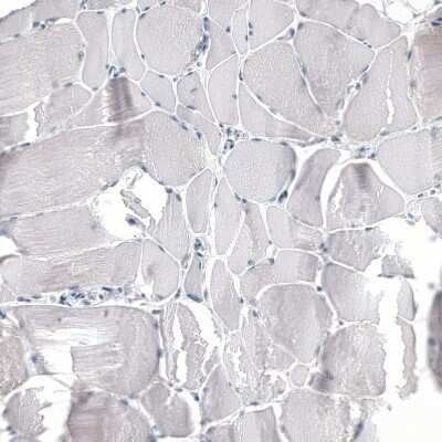 Immunohistochemistry-Paraffin: HO-1/HMOX1/HSP32 Antibody (CL11669) [NBP3-15122]