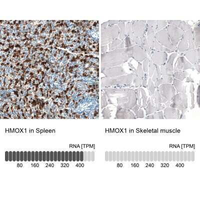 Immunohistochemistry-Paraffin: HO-1/HMOX1/HSP32 Antibody (CL11669) [NBP3-15122]