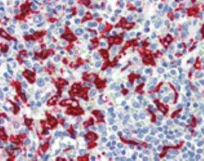 Immunohistochemistry-Paraffin: HO-1/HMOX1/HSP32 Antibody (HO-1-1) [NBP1-97507]