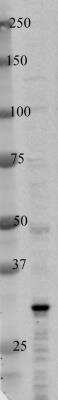 Western Blot: HO-1/HMOX1/HSP32 Antibody [NBP1-31341]