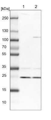 Western Blot: HO-2/HMOX2 Antibody [NBP1-91981]