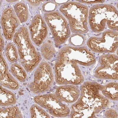 Immunohistochemistry-Paraffin: HOIP/RNF31 Antibody [NBP2-48914]