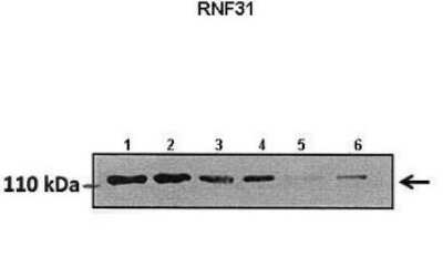 Western Blot: HOIP/RNF31 Antibody [NBP1-55059]