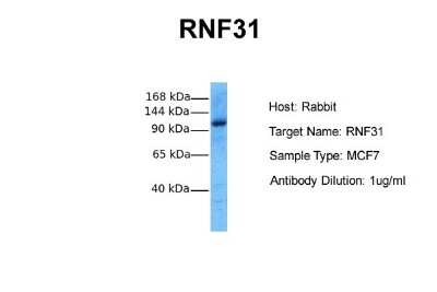 Western Blot: HOIP/RNF31 Antibody [NBP1-55059]