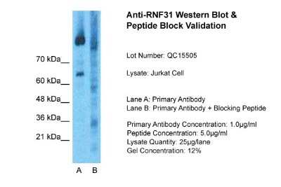 Western Blot: HOIP/RNF31 Antibody [NBP1-55059]