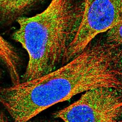 Immunocytochemistry/ Immunofluorescence: HOMER1 Antibody [NBP2-38309]