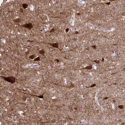 Immunohistochemistry-Paraffin: HOMER1 Antibody [NBP2-38308]