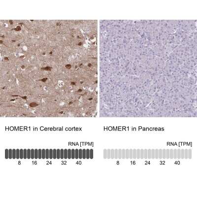Immunohistochemistry-Paraffin: HOMER1 Antibody [NBP2-38309]