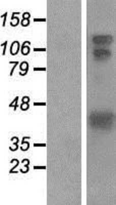 Western Blot: HOMER1 Overexpression Lysate [NBP2-07890]
