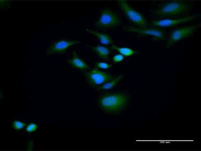 Immunocytochemistry/ Immunofluorescence: HOMER2 Antibody [H00009455-D01P]