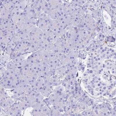 Immunohistochemistry-Paraffin: HOMER3 Antibody [NBP2-32607]