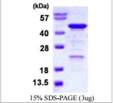 SDS-PAGE: Recombinant Human HOMER3 His Protein [NBP1-98979]