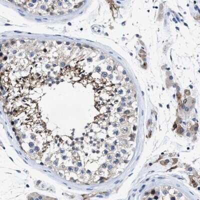 Immunohistochemistry-Paraffin: HOOK1 Antibody [NBP1-81744]