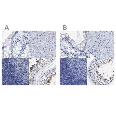 Immunohistochemistry-Paraffin: HOOK1 Antibody [NBP1-81744]