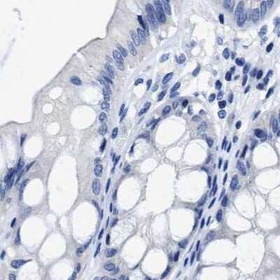 Immunohistochemistry-Paraffin: HOOK1 Antibody [NBP1-81744]