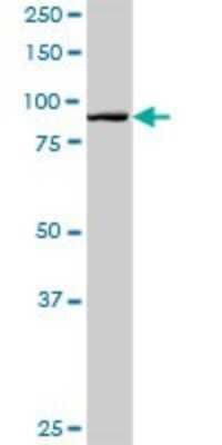 Western Blot: HOOK1 Antibody [H00051361-D01P]