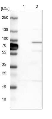 Western Blot: HOOK1 Antibody [NBP1-81744]
