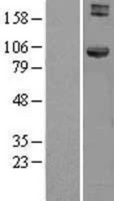 Western Blot: HOOK1 Overexpression Lysate [NBL1-11658]