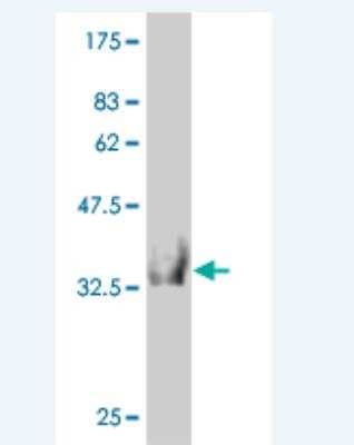 Western Blot: HOOK2 Antibody (1E10) [H00029911-M03]