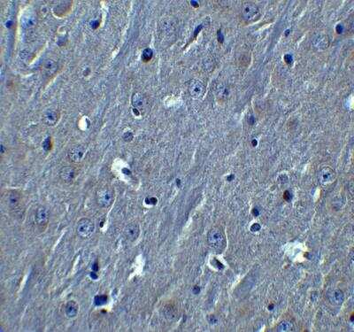 Immunohistochemistry: HOOK3 Antibody - BSA Free [NBP2-81990]
