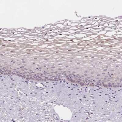 Immunohistochemistry-Paraffin: HOP Antibody [NBP1-92003]