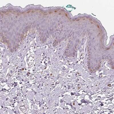 Immunohistochemistry-Paraffin: HOP Antibody [NBP1-92003]
