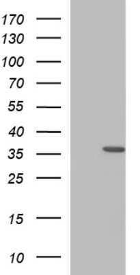 Western Blot: HORMAD2 Antibody (OTI3E4) [NBP2-45994]