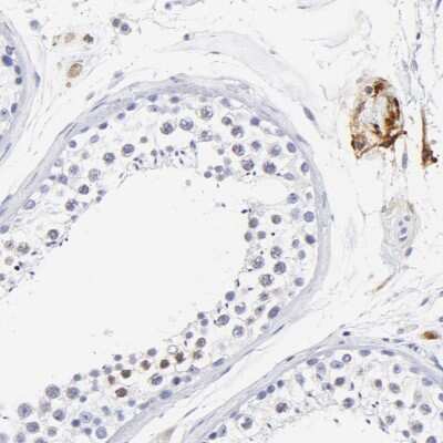 Immunohistochemistry-Paraffin: HORMAD2 Antibody [NBP1-82724]