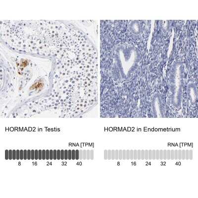 Immunohistochemistry-Paraffin: HORMAD2 Antibody [NBP1-82724]