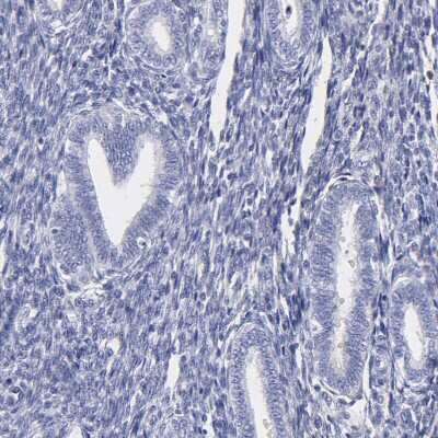 Immunohistochemistry-Paraffin: HORMAD2 Antibody [NBP1-82724]