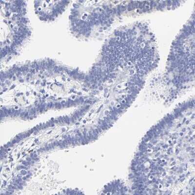 Immunohistochemistry-Paraffin: HORMAD2 Antibody [NBP1-82724]