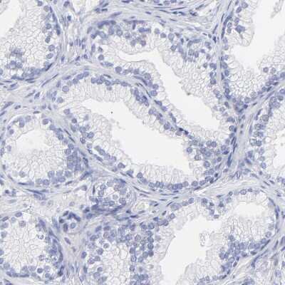 Immunohistochemistry-Paraffin: HORMAD2 Antibody [NBP1-82724]