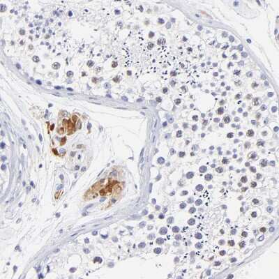Immunohistochemistry-Paraffin: HORMAD2 Antibody [NBP1-82724]