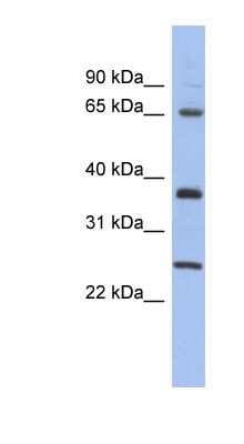 Western Blot: HORMAD2 Antibody [NBP1-52868]