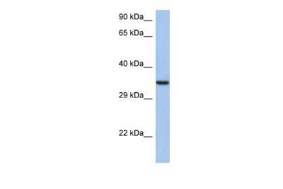 Western Blot: HORMAD2 Antibody [NBP2-87585]
