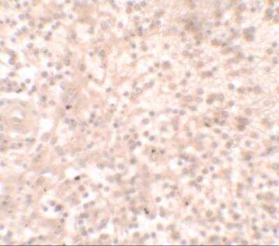 Immunohistochemistry: HOX11 Antibody - BSA Free [NBP2-81887]