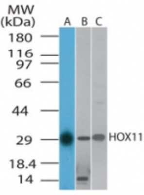 Western Blot: HOX11 Antibody [NB100-56424]