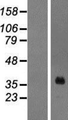 Western Blot: HOXA1 Overexpression Lysate [NBP2-07737]