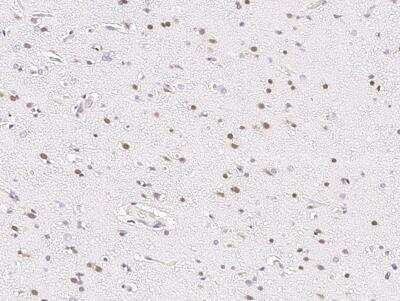 Immunohistochemistry-Paraffin: HOXA10 Antibody [NBP3-06103]