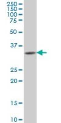 Western Blot: HOXA11 Antibody (5A3) [H00003207-M08]