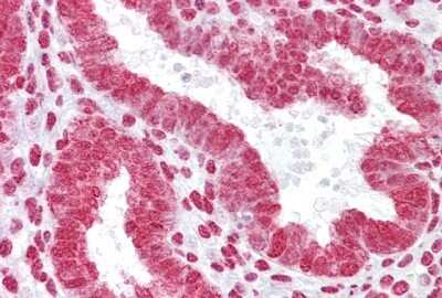 Immunohistochemistry-Paraffin: HOXA11 Antibody [NBP1-80228]
