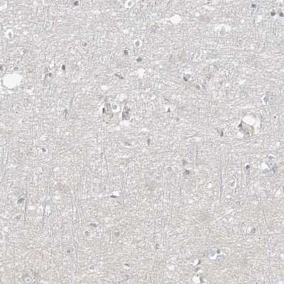 Immunohistochemistry-Paraffin: HOXA11 Antibody [NBP1-83233]