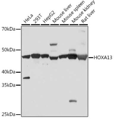 Western Blot: HOXA13 Antibody (5K0D5) [NBP3-16827]